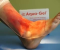 Aqua-Gel opatrunek hydrożelowy na poparzenia