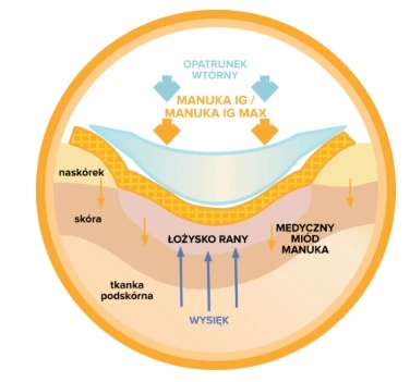 Manuka IG MAX aplikacja